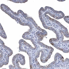 Anti-TTC21B Antibody