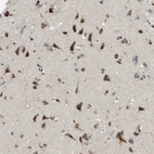 Anti-ADGRF2 Antibody