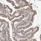Anti-HACL1 Antibody