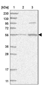 Lane 1: Marker [kDa] 230, 130, 95, 72, 56, 36, 28, 17, 11_br/_Lane 2: Human cell line RT-4_br/_Lane 3: Human cell line U-251MG sp
