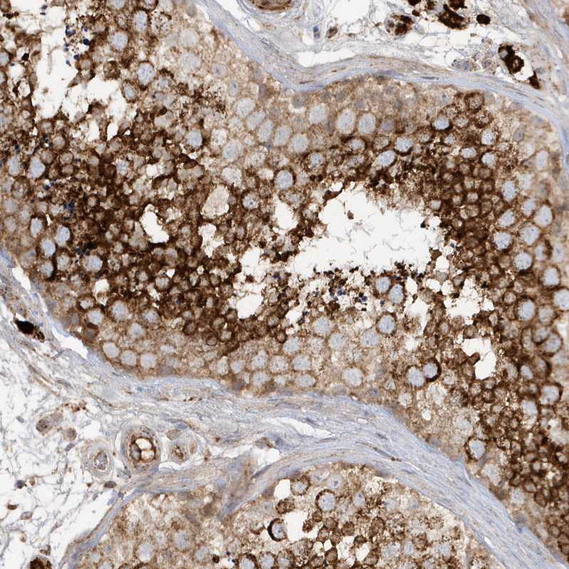 Anti-IFT57 Antibody