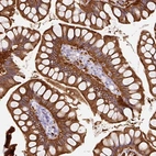 Immunohistochemical staining of human small intestine shows strong cytoplasmic positivity in glandular cells.