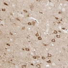 Anti-KSR2 Antibody