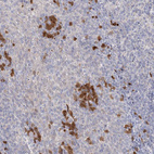 Immunohistochemical staining of human tonsil shows moderate cytoplasmic positivity in lymphoid cells.