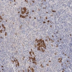 Immunohistochemical staining of human tonsil shows moderate cytoplasmic positivity in lymphoid cells.