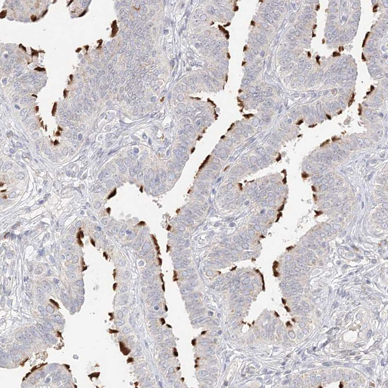 Anti-TRANK1 Antibody