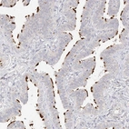Anti-TRANK1 Antibody