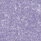 Immunohistochemical staining of human lymph node shows no positivity in non-germinal center cells as expected.