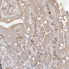 Immunohistochemical staining of human duodenum shows moderate cytoplasmic positivity in lymphoid cells.
