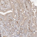 Immunohistochemical staining of human duodenum shows moderate cytoplasmic positivity in lymphoid cells.