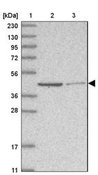 Lane 1: Marker [kDa] 230, 130, 95, 72, 56, 36, 28, 17, 11_br/_Lane 2: Human cell line RT-4_br/_Lane 3: Human cell line U-251MG sp