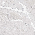 Immunohistochemical staining of human skeletal muscle shows no positivity in myocytes as expected.