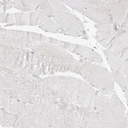 Immunohistochemical staining of human skeletal muscle shows no positivity in myocytes as expected.