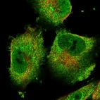 Immunofluorescent staining of human cell line U-251 MG shows localization to nucleoplasm, plasma membrane & cytosol.