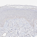Immunohistochemical staining of human skin shows no positivity in squamous epithelial cells as expected.