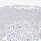 Immunohistochemical staining of human skin shows no positivity in squamous epithelial cells as expected.