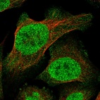 Immunofluorescent staining of human cell line U-2 OS shows localization to nucleoplasm.