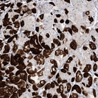 Anti-MARS2 Antibody