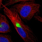 Immunofluorescent staining of human cell line U-2 OS shows localization to intermediate filaments & aggresome.