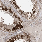Anti-CETN3 Antibody