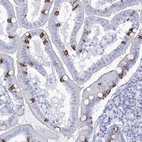 Immunohistochemical staining of human duodenum shows strong granular cytoplasmic positivity in glandular cells.