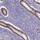 Anti-SETD5 Antibody