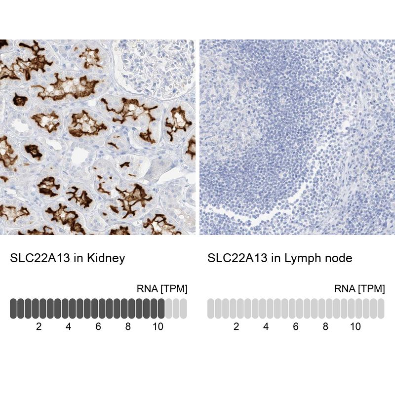 Anti-SLC22A13 Antibody