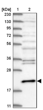 Lane 1: Marker [kDa] 230, 130, 95, 72, 56, 36, 28, 17, 11_br/_Lane 2: Human cell line RT-4