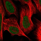 Immunofluorescent staining of human cell line U-2 OS shows localization to nucleoplasm.