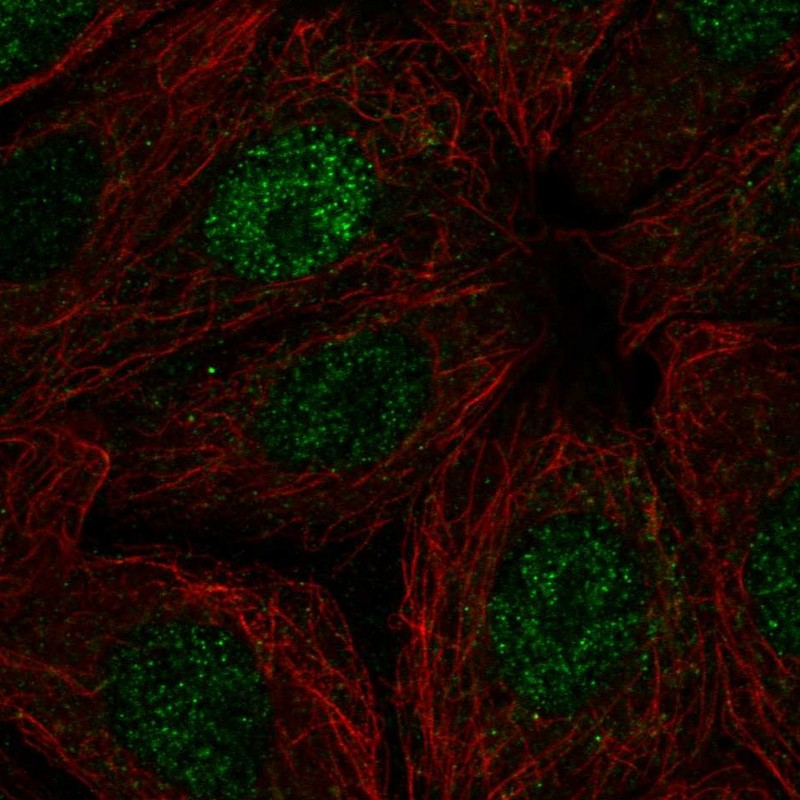 Anti-POLR2I Antibody