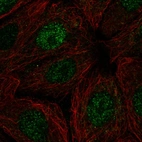 Anti-POLR2I Antibody