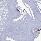 Immunohistochemical staining of human skin shows no positivity in squamous epithelial cells as expected.