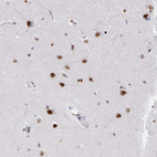 Immunohistochemical staining of human cerebral cortex shows moderate nuclear positivity in neurons.