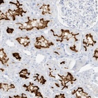 Anti-SLC22A13 Antibody