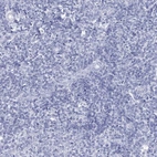 Immunohistochemical staining of human tonsil shows no positivity in non-germinal center cells as expected.