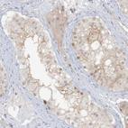 Immunohistochemical staining of human testis shows weak to moderate membranous and cytoplasmic positivity in cells in seminiferous ducts.