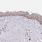 Immunohistochemical staining of human skin shows moderate nuclear positivity in squamous epithelial cells.