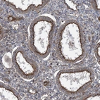 Immunohistochemical staining of human endometrium shows strong membranous positivity in glandular cells.