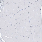 Immunohistochemical staining of human skeletal muscle shows no positivity in myocytes as expected.