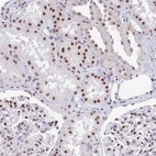 Immunohistochemical staining of human kidney shows moderate nuclear positivity in cells in tubules.