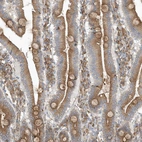 Immunohistochemical staining of human duodenum shows moderate membranous positivity in glandular cells.