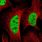Immunofluorescent staining of human cell line U-2 OS shows localization to nucleoplasm.
