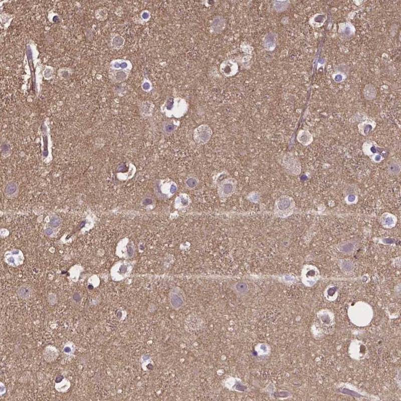 Anti-CRMP1 Antibody