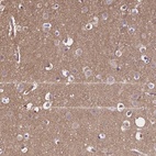 Anti-CRMP1 Antibody
