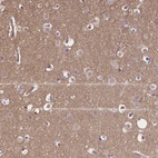 Anti-CRMP1 Antibody