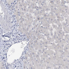 Immunohistochemical staining of human liver shows no positivity in hepatocytes as expected.