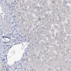 Immunohistochemical staining of human liver shows no positivity in hepatocytes as expected.
