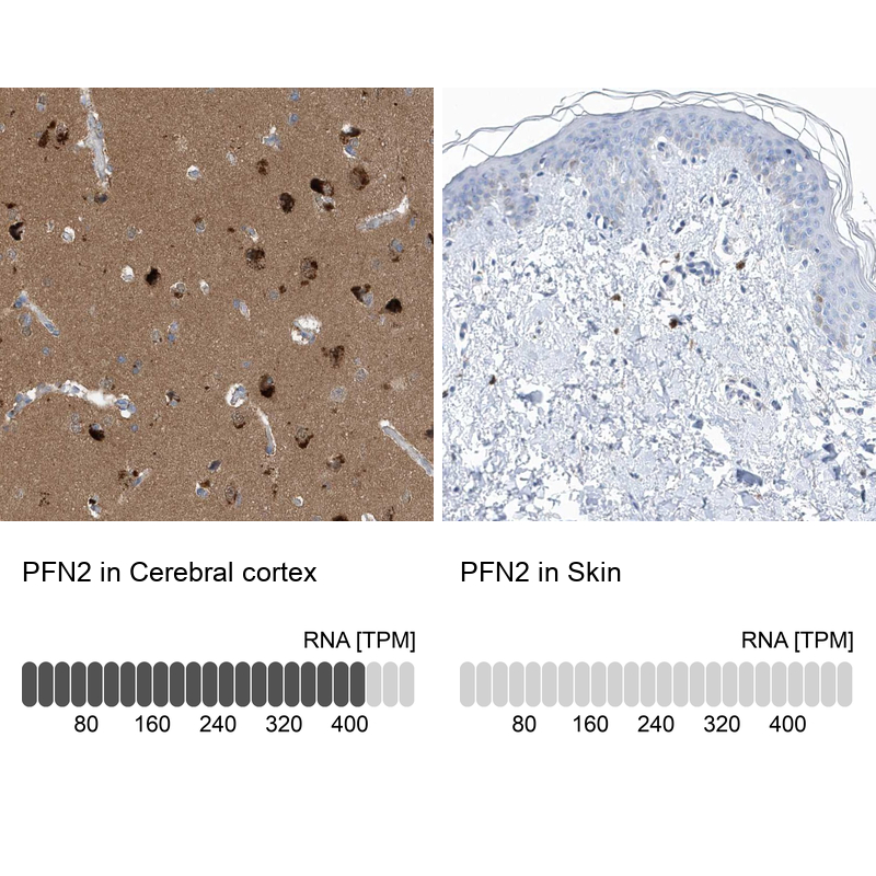 Anti-PFN2 Antibody