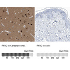 Anti-PFN2 Antibody