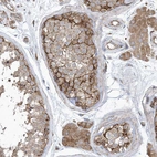 Immunohistochemical staining of human testis shows strong membranous positivity in cells in seminiferous ducts.